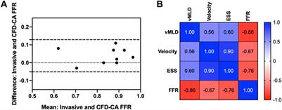 Evaluation of intracoronary hemodynamics identifies perturbations in vorticity